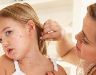 Source behind Disneyland Measles Outbreak not easy to be identified Source behind Disneyland Measles Outbreak not easy to be identified