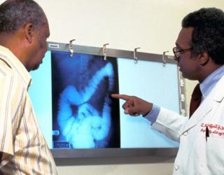 Screening could cut more than 20,000 Annual Deaths from Colon Cancer