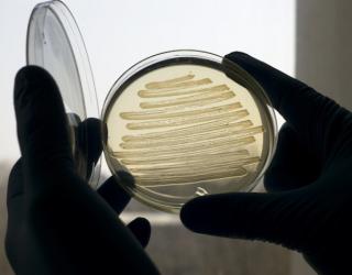 Researchers obtain First Images of Smallest Bacteria on Earth Researchers obtain First Images of Smallest Bacteria on Earth