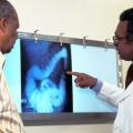 Screening could cut more than 20,000 Annual Deaths from Colon Cancer