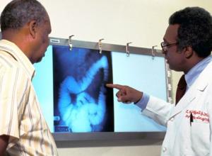 Screening could cut more than 20,000 Annual Deaths from Colon Cancer